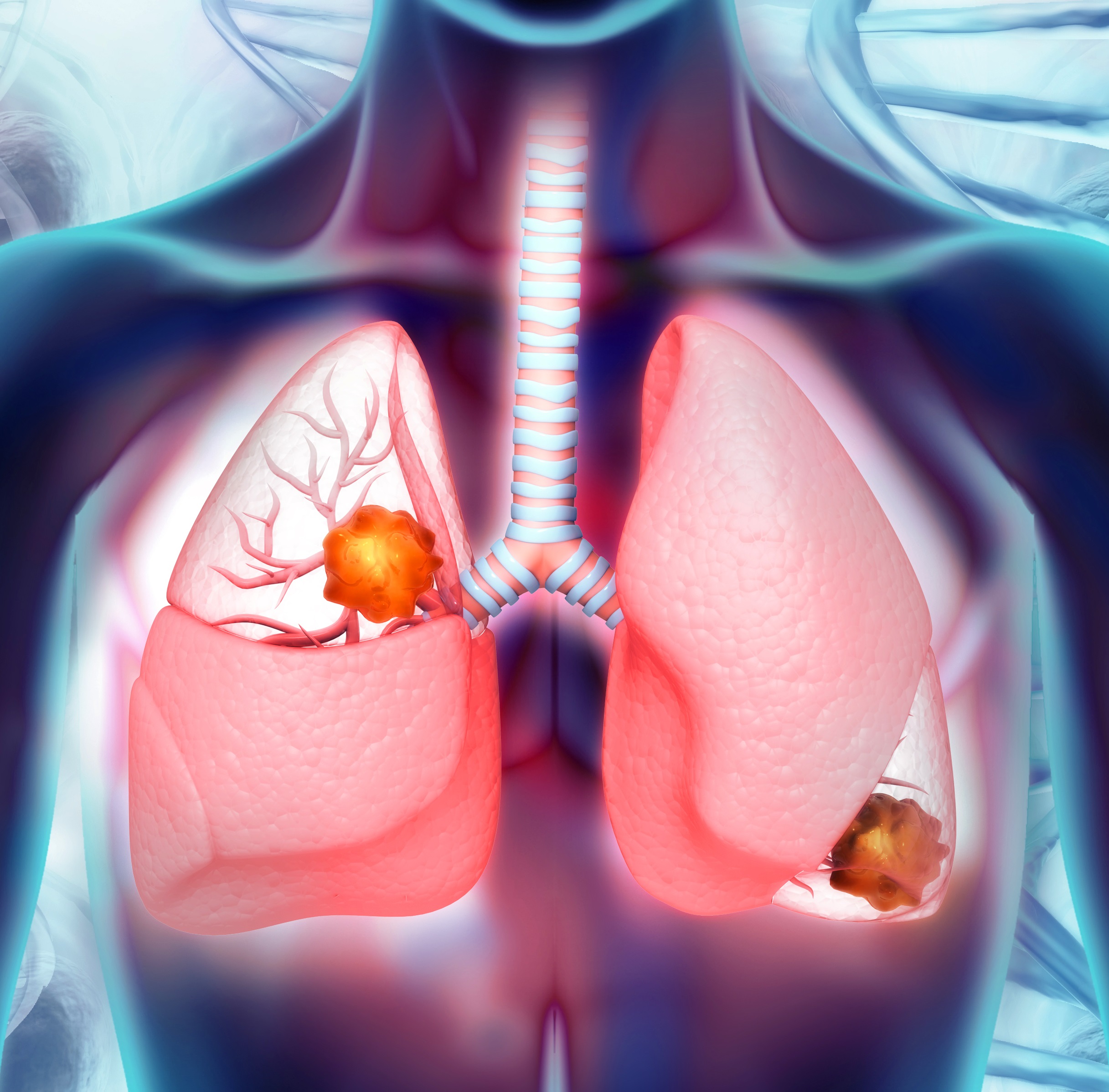 Hendrick Health Launches Lung Nodule Program For Earlier Detection